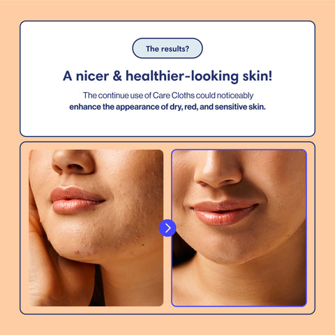 Ultra Deluxe Disposable Face Towel - MAXI - 50 pc